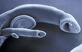 Pair of schistosomes in a scanning electron microscope ; The female is fitted in the male.<br>The schistosome is a parasite of the human circulatory system.<br>Eggs for this species are evacuated in the stools and release a miracidium in presence of water. The miracidium finds a mollusc host where it becomes a sporocyst, producing more sporocysts which will then produce cercariae. The cercariae then break out of the mollusc and enter their human host through the skin. They get carried to the liver where they become adults.