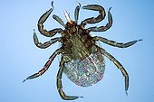Close up of a sheep tick female under the microscope  ; Enlargement x 50. <br><br>