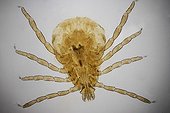 American dog tick under microscope ; Lighting in bright background, magnification x 20