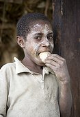 Boy eating a sweet potato Papua New Guinea ; Papua New Guinea many problems of malnutrition exist because children eat potatoes all day. 