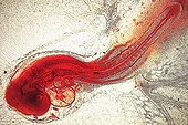 Chick embryo 48 hours  ; Oblique illumination in brightfield, x 20