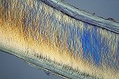 Cross section of a human incisor  ; Polarized light illumination compensator plate cellophane x 50