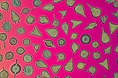 Radiolarians on pink background  ; Polarized light illumination compensator plate gypsum, x 50
