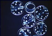 Fish eggs as found in sea water, ie as marine plankton. The oil bubbles that are the nutrient reserves of the larvae are seen for the following days.