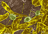 1 - Three sclerotia of Ophiognomonia on a background of moss. 1 - In the center, three sclerotia in the process of formation. 2 - Germ tube (arrow) coming out of the spore; 3 - Eight to ten Ophiognomonia spores (in yellow) on a background of moss. SEM X 2000 .