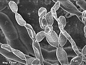 Details of the hyphae producing asci of Alternaria alternata. Les Cerfs, Le Houga (32460) - MEB le 22..09.2020 - X 4500 -