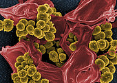 Scanning electron micrograph of methicillin-resistant Staphylococcus aureus and a dead human neutrophil.
