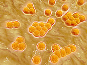Microscopic view of Methicillin-resistant Staphylococcus aureus (MRSA). MRSA is a bacterium responsible for several difficult-to-treat infections in humans. It is also called oxacillin-resistant Staphylococcus aureus.