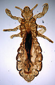 Head louse (Pediculus humanus)