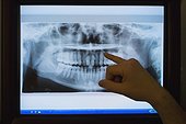 Orthodontist Examining X-ray