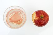 False teeth, dentures in a glass of water beside an apple