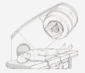 Black and white illustration of a patient undergoing radiation therapy